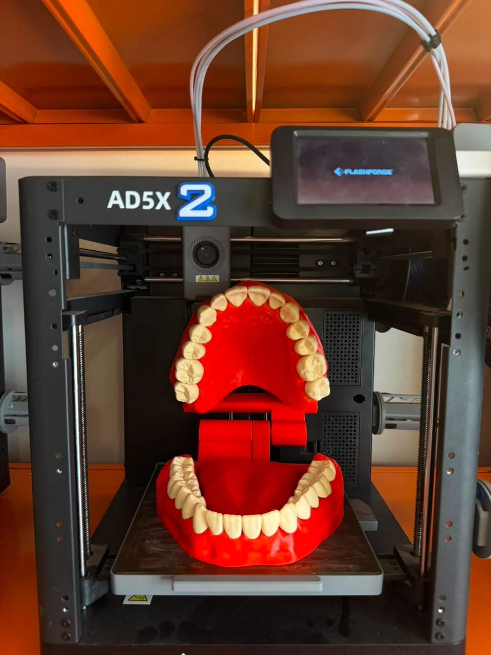 The dental model shown inside an Alamat Solutions 3D printer.