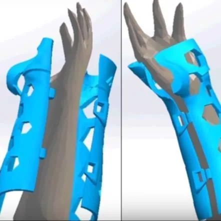 الطباعة ثلاثية الأبعاد في الطب